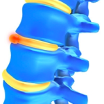 Alexander Technique and Back Pain Relief